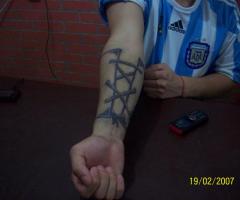Mi brazalete