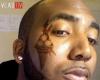 Tattoo of three scoop ice cream cone on his face