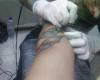 Mi endo arm en el proceso