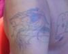 Leon Rasta en brazo - Ante y Despues
