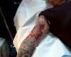 Arm tattoo