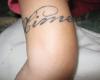 BRAZALETE