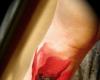 Poppy flower tattoo