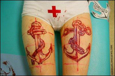 Ancla Escarificación / Anchor Scarification