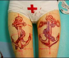 Ancla Escarificación / Anchor Scarification