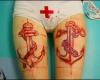 Ancla Escarificación / Anchor Scarification