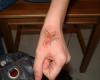 Tatuaggi farfalla tatuaggio sulla mano