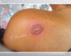 A kiss tattoo