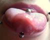 tongue