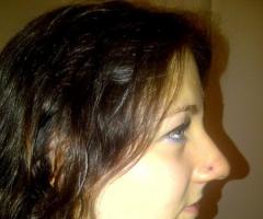 nostril