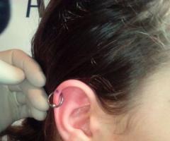 helix