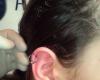 helix
