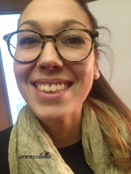 frenillo superior labio